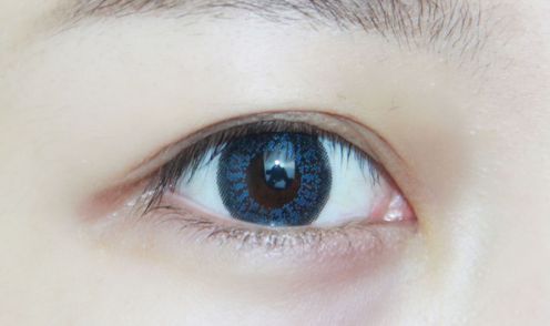 深圳大學(xué)北醫(yī)院最新雙眼皮手術(shù)效果評(píng)測(cè)報(bào)告！費(fèi)用一覽表供查看