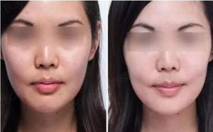 廣州生殖器整形醫(yī)院實力口碑排行：助你重拾自信！