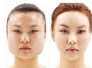 鹽城激光祛疤效果好的美容醫(yī)院推薦，哪家值得信賴？