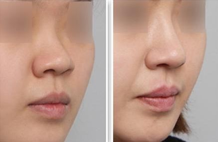 韓國眼皮微整形醫(yī)院綜合排名，精選優(yōu)質(zhì)機(jī)構(gòu)助你煥新容顏！