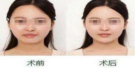 貴陽(yáng)飛頓醫(yī)院：彩光口碑技術(shù)全揭秘！