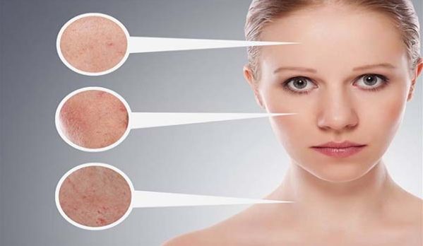 沈陽果酸換膚縮毛孔正規(guī)醫(yī)院排名及醫(yī)生評價TOP10