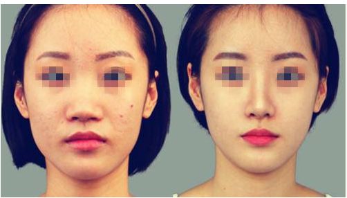 【常德】十大光雕溶脂瘦臉醫(yī)院排名揭秘：全面解析！