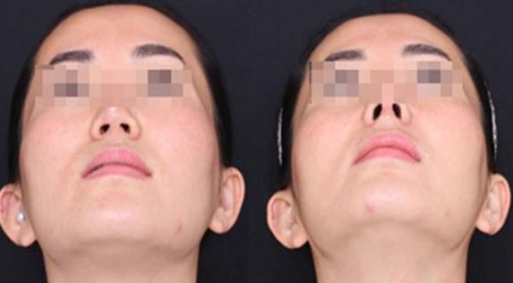 長沙祛除眼底紋口碑前十強(qiáng)醫(yī)療美容機(jī)構(gòu)揭曉！