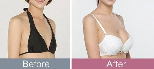 桂林前十強(qiáng)上臉下垂美容醫(yī)院大盤點(diǎn)