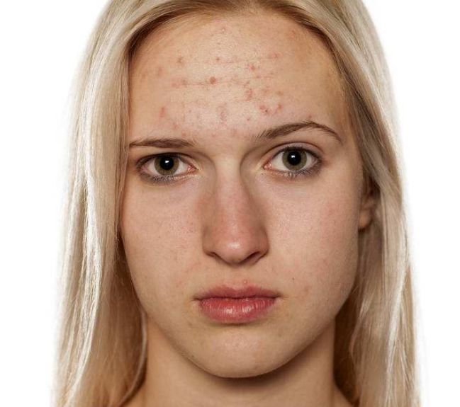 合肥去眼睛細(xì)紋醫(yī)院實(shí)力排行榜Top 10