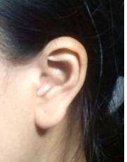 南昌哪家醫(yī)院口碑好？肉毒素填充眼紋排行榜前十！