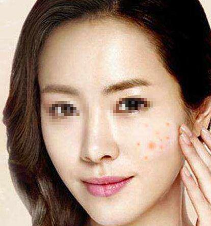 沈陽(yáng)深度皺紋整形醫(yī)院口碑排行榜2024：前十強(qiáng)名單揭曉！