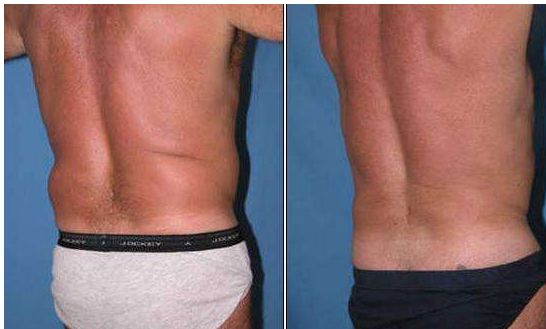 石家莊哪家醫(yī)院治法令紋效果比較好？排名前十大揭曉！