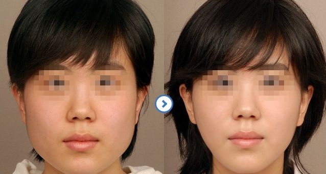 北京皮秒洗眉整形醫(yī)院推薦：10家技術(shù)精湛，值得信賴！