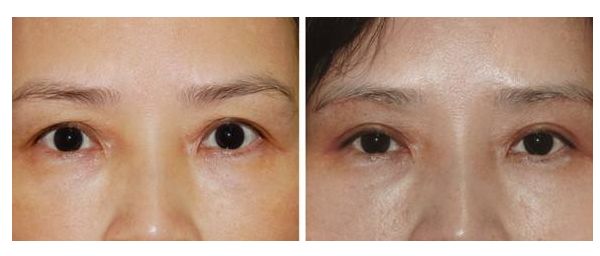 南京有哪些皮膚清潔美容院值得推薦呢？