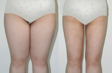 山東哪家醫(yī)院注射肉毒素效果好？TOP10強推薦！