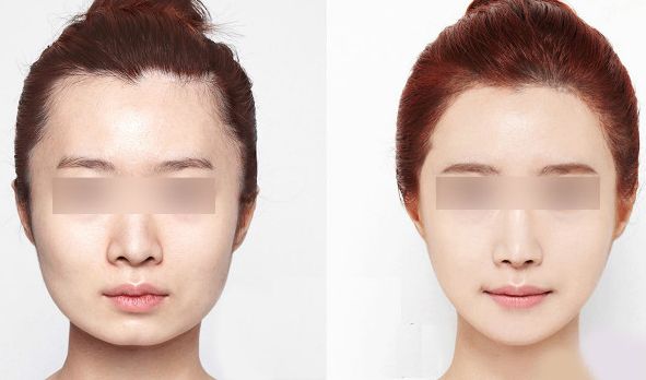 武漢眼紋提升手術(shù)醫(yī)院推薦名單