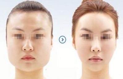 蚌埠提升面部哪里做得好？這10家正規(guī)整形醫(yī)院值得信賴