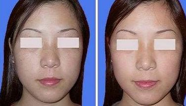 河北中醫(yī)按摩權(quán)威醫(yī)院排名及口碑解析，前10強醫(yī)院實力盤點！