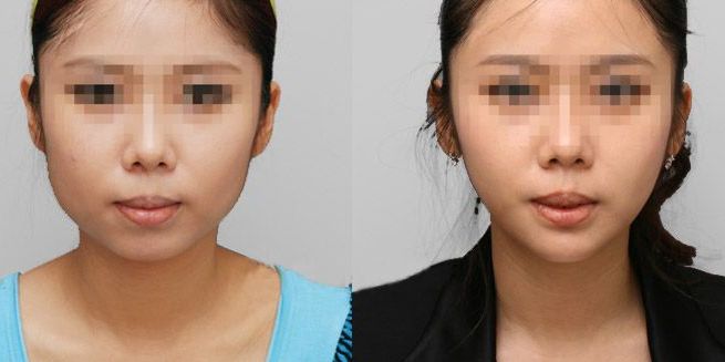 揭秘！淮安治療痤瘡疤痕效果好的整形機(jī)構(gòu)10強(qiáng)