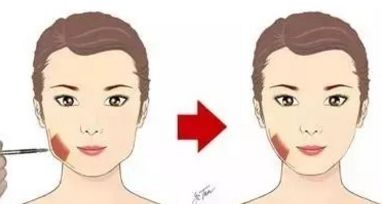 重慶去口周紋整形醫(yī)院排行榜及評價，讓你輕松選出最適合的醫(yī)院!