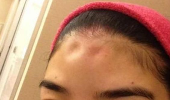 太原口碑佳的頸脖紋激光祛除醫(yī)院推薦TOP10