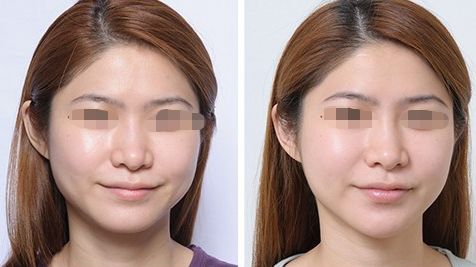 武漢去哪里洗紋身比較好？醫(yī)院推薦！