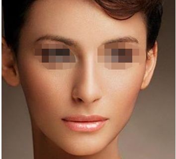 探索廈門環(huán)形聚能震波吸脂整形醫(yī)院前十排名