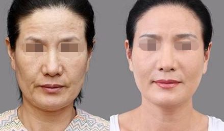 邵陽(yáng)淚溝填充醫(yī)院推薦：口碑十佳機(jī)構(gòu)實(shí)力見(jiàn)證