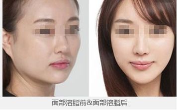 佛山口碑好的處女膜修復(fù)醫(yī)院推薦