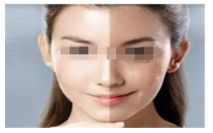 廈門面部皺紋提拉專家推薦：TOP10正規(guī)整形醫(yī)院排行榜