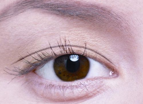 種植發(fā)際線手術(shù)后為何會出現(xiàn)水腫現(xiàn)象 術(shù)后幾天可洗頭