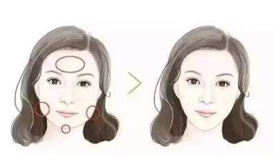 拉美面部提升與加減美的技術(shù)差異決定效果，專注于穆寶安與黃寅守的技術(shù)對(duì)比