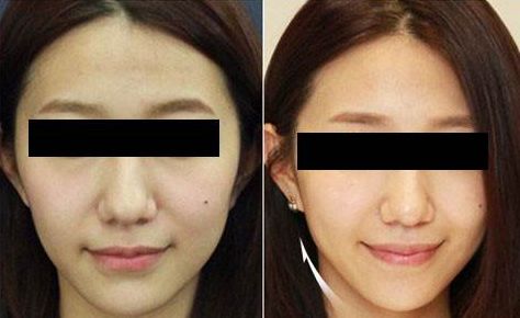 深圳痘痘整形醫(yī)院人氣10強(qiáng)大盤(pán)點(diǎn)