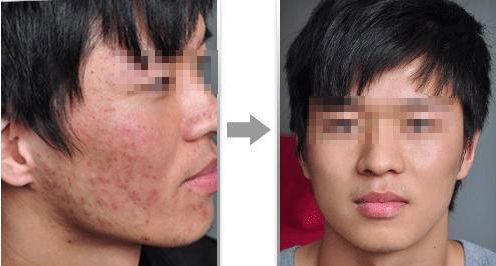 蚌埠哪家吸脂瘦大腿醫(yī)院口碑好？前10排名推薦