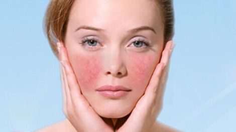 自體脂肪填充臥蠶，讓你輕松擁有迷人外貌！