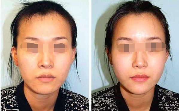 洛陽祛除頸紋實力榜單：10家口碑整形醫(yī)院推薦