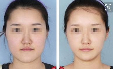 蘇州眼底紋填充十佳整形醫(yī)院實(shí)地排名，你需要了解的最新資訊！