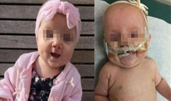 寧波提拉眼角紋醫(yī)院排名前十強！精準(zhǔn)推薦，解決眼角紋難題！