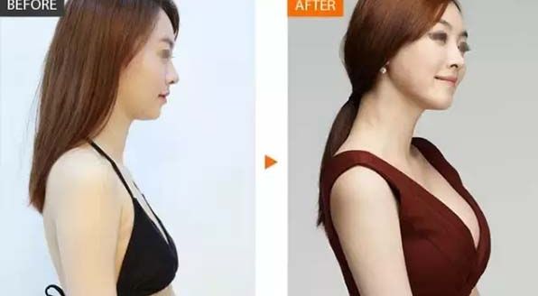 成都頸紋注射十大拔萃醫(yī)院，揭秘技藝流派