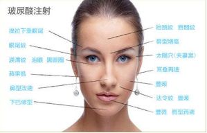 成都自體煥顏醫(yī)院精選前十大熱門項目詳解！