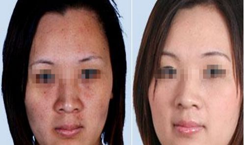 佛山口周紋剝離專業(yè)醫(yī)院排行榜出爐！TOP10強(qiáng)實(shí)力評測揭曉