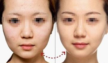 河南眉弓填充整形醫(yī)院口碑實(shí)力大盤點(diǎn)