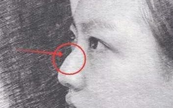 杭州有哪些優(yōu)質(zhì)醫(yī)院提供玻尿酸填充服務(wù)？專家盤(pán)點(diǎn)技術(shù)，微整合法合規(guī)可靠！