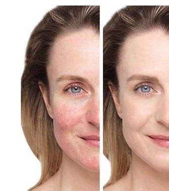 昆明哪家激光祛魚尾紋醫(yī)院口碑比較好？排名前10名名單揭曉！