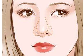 煙臺(tái)哪家鐳射祛胎記醫(yī)院口碑好？排名前10名榜單揭曉！