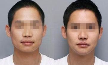 南京地區(qū)鼻尖鼻翼整形醫(yī)院綜合實(shí)力排行榜前十