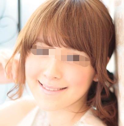 上海鮮紅斑痣微磨術口碑前十強醫(yī)院推薦