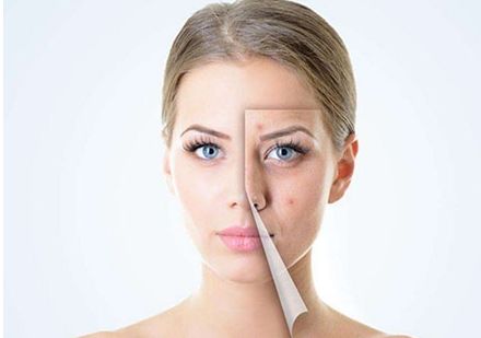 惠州痘印點陣激光醫(yī)院哪家好？10大權(quán)威機構(gòu)全面解析