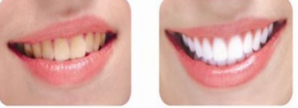 深圳下眼皮激光祛皺口碑醫(yī)院排名TOP10