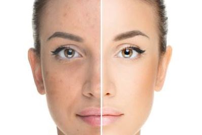 長沙專業(yè)光雕溶脂瘦腹醫(yī)院排名前十詳解