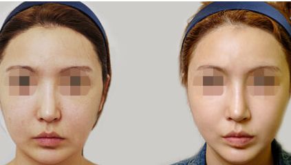 2023年北京磨骨醫(yī)院榜單揭曉！找尋醫(yī)療服務只需輕輕一點