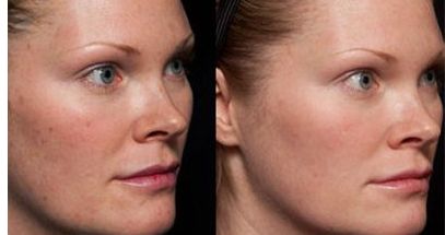 紹興皺紋激光修復(fù)醫(yī)院口碑榜單：前10強(qiáng)實力大揭秘！