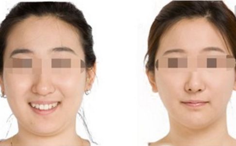 湖州短鼻矯正優(yōu)質(zhì)醫(yī)療機(jī)構(gòu)排行榜發(fā)布